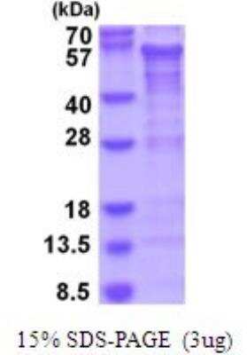 SDS-PAGE: Recombinant Human CREB3L2 His Protein [NBP2-51927]