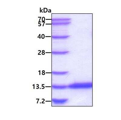 SDS-PAGE: Recombinant Human CRIP1 His Protein [NBP2-22979]