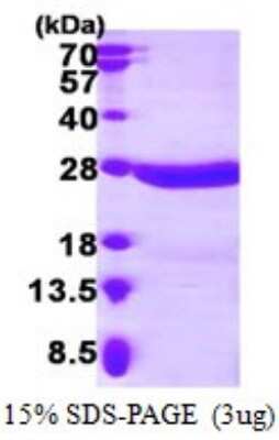 SDS-PAGE: Recombinant Human CRYBA4 His Protein [NBP1-72411]