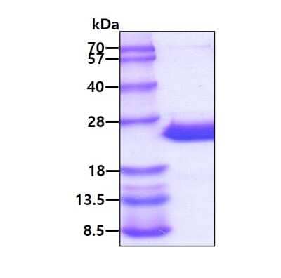 SDS-PAGE: Recombinant Human CRYGD His Protein [NBP1-72428]