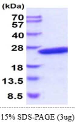 SDS-PAGE: Recombinant Mouse CRYGD His Protein [NBP2-61974]