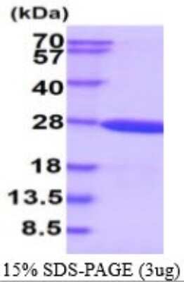 SDS-PAGE: Recombinant Human CRYGS His Protein [NBP1-72447]