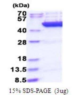 SDS-PAGE: Recombinant Human CS Citrate Synthase His Protein [NBP2-51818]