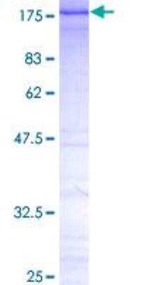 SDS-PAGE: Recombinant Human CTCF GST (N-Term) Protein [H00010664-P01]