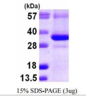 SDS-PAGE: Recombinant Human CTDSP1 His Protein [NBP1-51081]