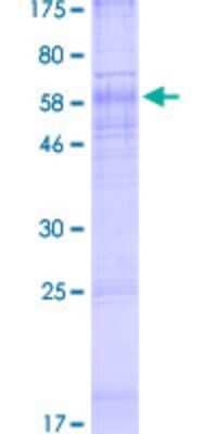 SDS-PAGE: Recombinant Human CTNS GST (N-Term) Protein [H00001497-P01]