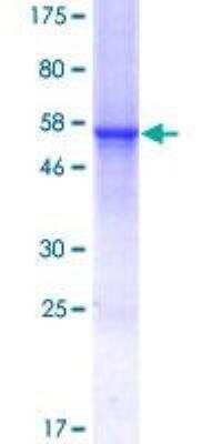 SDS-PAGE: Recombinant Human CTRP7 GST (N-Term) Protein [H00114905-P01]