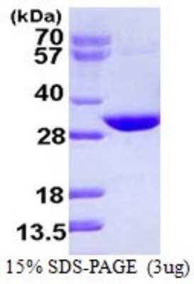 SDS-PAGE: Recombinant Human CUTC His Protein [NBP1-72425]