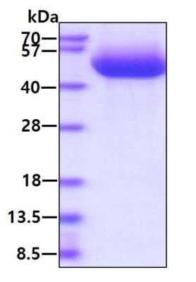 SDS-PAGE: Recombinant Human CX3CL1/Fractalkine His Protein [NBP2-77496]