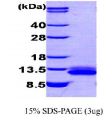 SDS-PAGE: Recombinant Human CXCL12/SDF-1 His Protein [NBC1-27995]