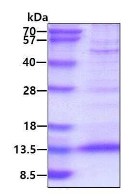 SDS-PAGE: Recombinant Human CXCL4L1 His Protein [NBP2-51668]