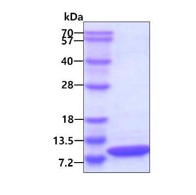 SDS-PAGE: Recombinant Human CXCL8/IL-8 Protein [NBC1-18459]