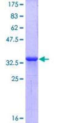 SDS-PAGE: Recombinant Human CXCR4 GST (N-Term) Protein [H00007852-Q01]