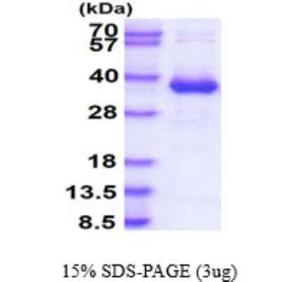 SDS-PAGE: Recombinant Human CYB5R3 His Protein [NBP1-78879]