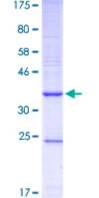 SDS-PAGE: Recombinant Human CYP1B1 GST (N-Term) Protein [H00001545-Q01]