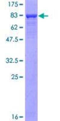 SDS-PAGE: Recombinant Human CaM Kinase II alpha GST (N-Term) Protein [H00000815-P01]