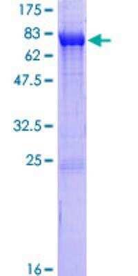 SDS-PAGE: Recombinant Human CaM Kinase II delta GST (N-Term) Protein [H00000817-P01]