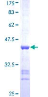 SDS-PAGE: Recombinant Human CaM Kinase II delta GST (N-Term) Protein [H00000817-Q01]