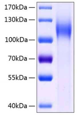 SDS-PAGE: Recombinant Human Cadherin-17 His (C-Term) Protein [NBP3-18199]