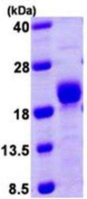 SDS-PAGE: Recombinant Human Calcineurin B His Protein [NBP1-78797]