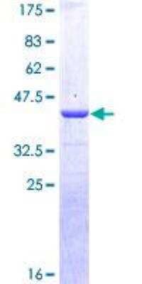 SDS-PAGE: Recombinant Human Calcitonin GST (N-Term) Protein [H00000796-P01]