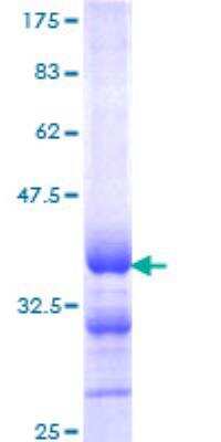 SDS-PAGE: Recombinant Human Calcitonin GST (N-Term) Protein [H00000796-Q01]