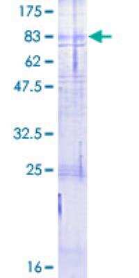 SDS-PAGE: Recombinant Human Calcitonin R GST (N-Term) Protein [H00000799-P01]