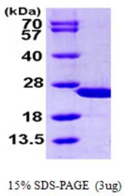 SDS-PAGE: Recombinant Human Calcyphosine His Protein [NBP1-51001]