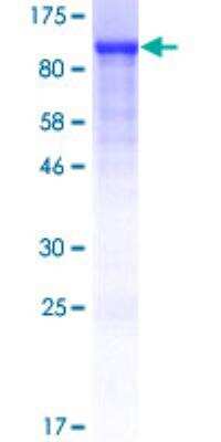 SDS-PAGE: Recombinant Human Caldesmon/CALD1 GST (N-Term) Protein [H00000800-P01]