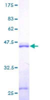 SDS-PAGE: Recombinant Human Calmodulin 2 GST (N-Term) Protein [H00000805-P01]