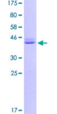 SDS-PAGE: Recombinant Human Calmodulin 2 GST (N-Term) Protein [H00000805-P02]