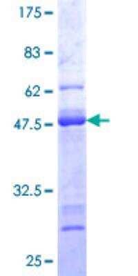 SDS-PAGE: Recombinant Human Calmodulin 3 GST (N-Term) Protein [H00000808-P01]