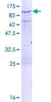 SDS-PAGE: Recombinant Human Calpain 2 GST (N-Term) Protein [H00000824-P01]