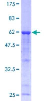 SDS-PAGE: Recombinant Human Calpain 3 GST (N-Term) Protein [H00000825-P01]