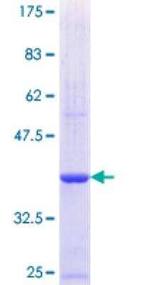 SDS-PAGE: Recombinant Human Calpain 3 GST (N-Term) Protein [H00000825-Q01]