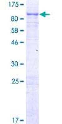 SDS-PAGE: Recombinant Human Calpain 5 GST (N-Term) Protein [H00000726-P01]