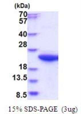 SDS-PAGE: Recombinant Human Calpain S1 His Protein [NBP2-51694]