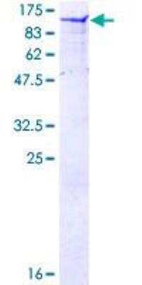 SDS-PAGE: Recombinant Human Calpastatin GST (N-Term) Protein [H00000831-P01]