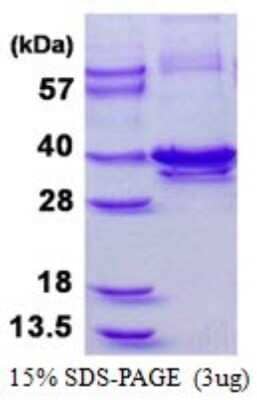 SDS-PAGE: Recombinant Human Calponin 1 His Protein [NBP1-98945]