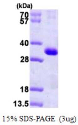 SDS-PAGE: Recombinant Human Calsenilin His Protein [NBP1-50875]