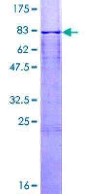 SDS-PAGE: Recombinant Human Calsequestrin 1 GST (N-Term) Protein [H00000844-P01]