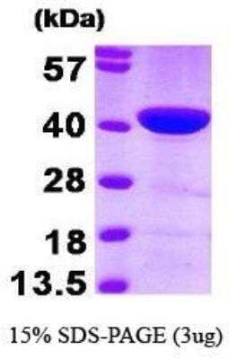 SDS-PAGE: Recombinant Human CapG Protein [NBP1-30303]