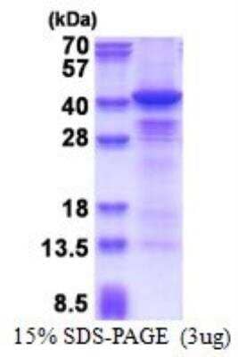 SDS-PAGE: Recombinant Human Casein Kinase 1 alpha His Protein [NBP2-51623]