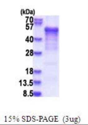 SDS-PAGE: Recombinant Human Casein Kinase 1 delta His Protein [NBP2-51703]