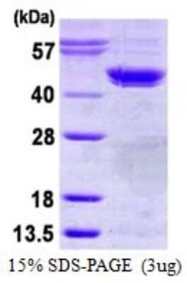 SDS-PAGE: Recombinant Human Casein Kinase 2 alpha His Protein [NBP1-99066]