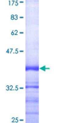 SDS-PAGE: Recombinant Human Caspase-1 GST (N-Term) Protein [H00000834-Q01]