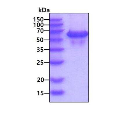 SDS-PAGE: Recombinant Human Cathepsin F His Protein [NBP3-11848]