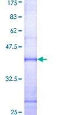 SDS-PAGE: Recombinant Human Cathepsin G GST (N-Term) Protein [H00001511-Q01]