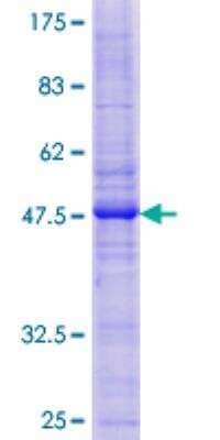 SDS-PAGE: Recombinant Human Caveolin-2 GST (N-Term) Protein [H00000858-P01]