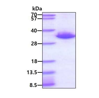 SDS-PAGE: Recombinant Human Cdk5 His Protein [NBP2-61169]